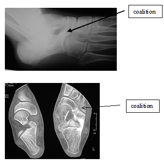 CoalitionXray