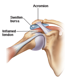 Acromion