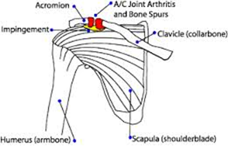 Joint Arthritis